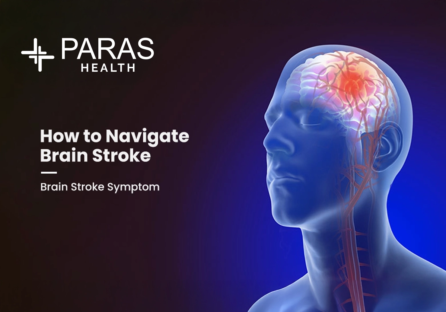 How to Navigate Brain Stroke – Brain Stroke Symptoms, Brain Stroke Management